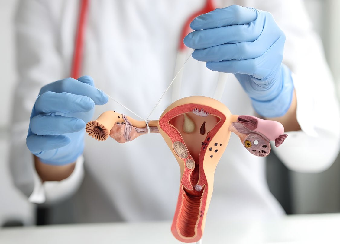 Blocked Fallopian Tubes? Causes, Symptoms, and Natural Supplement Solution