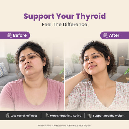 Narie Thyroid Care Tablets
