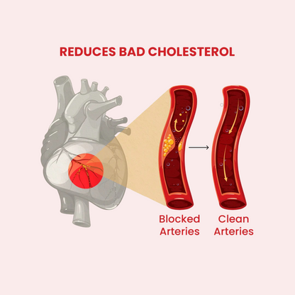 Illustration showing a heart and a comparison of blocked versus clean arteries, highlighting cholesterol buildup inside blood vessels and improved arterial flow after reduction of plaque.